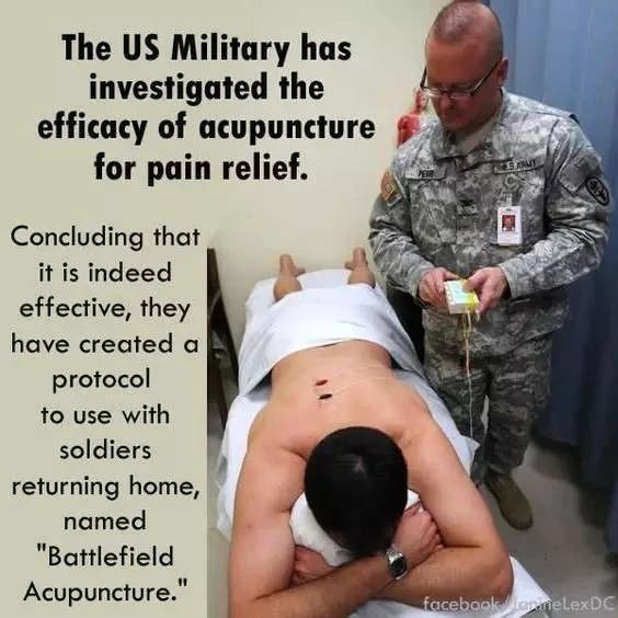 美军效仿东方医术，正秘密研究针灸等中医特色疗法